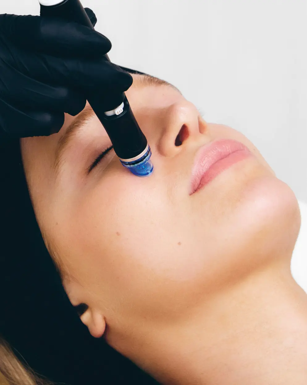 HydraFacial